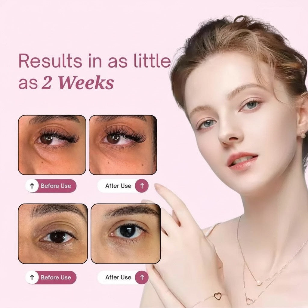 Luméa Eyes V2 – Lunettes de sommeil & anti-cernes